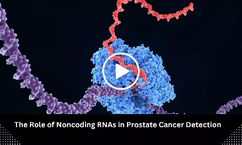 Exploring Role of Noncoding RNAs for Prostate Cancer Detection: Review highlights