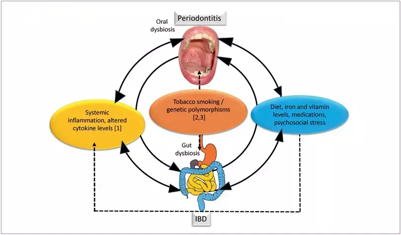 Intermittent fasting linked to decreased  systematic and periodontal  inflammation, finds study