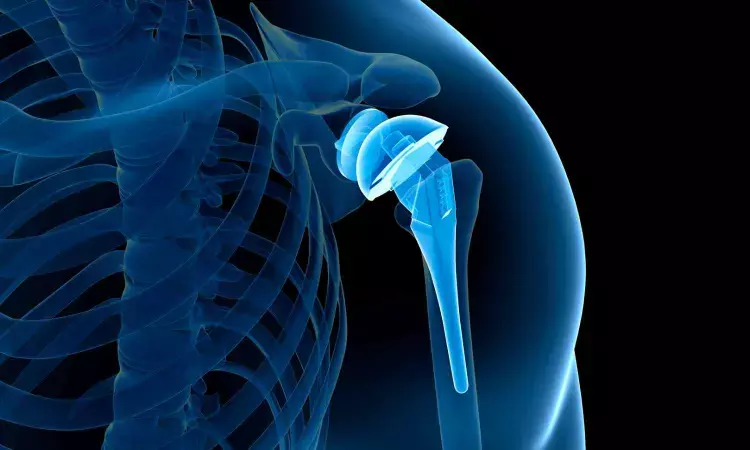 Novel shoulder arthroplasty Surgery Utilizing Groundbreaking Mixed Reality Technology unveiled in new study