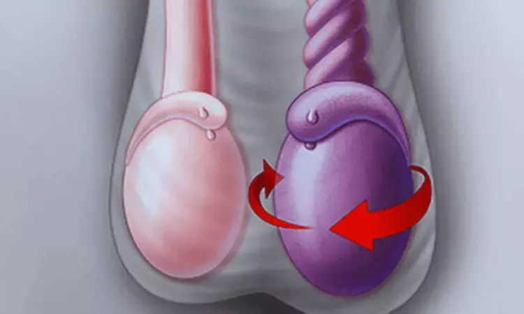 Ultrasonography Crucial in Preoperative Diagnosis and Rescue of Ectopic Testis with Torsion: Case Report