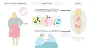 Pre-pregnancy bariatric surgery associated with reduction in several obesity related pregnancy complications: Study