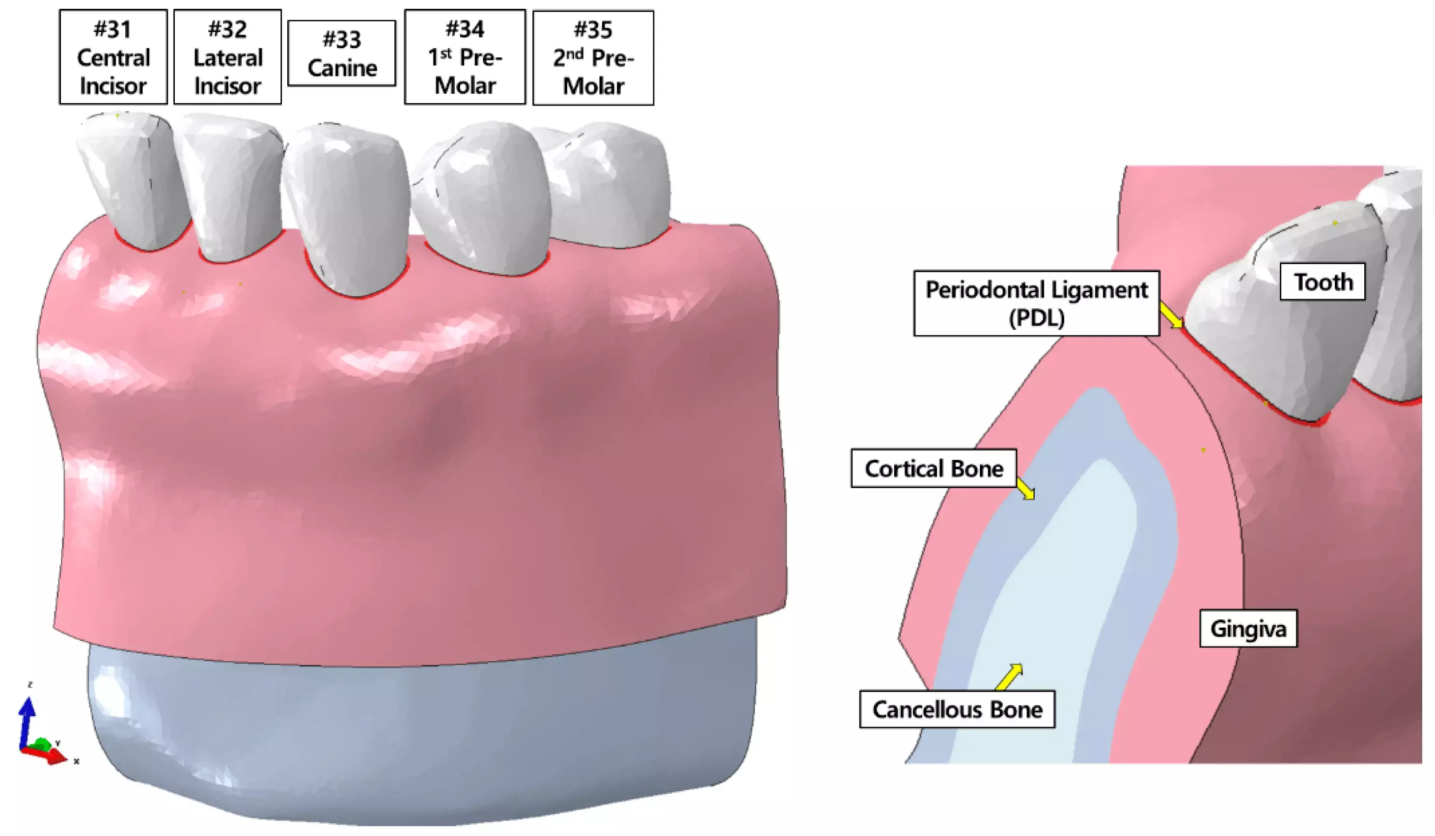 Fixed orthodontic appliances trigger more gingival changes than clear aligners: Study