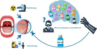 Sucralfate mouthwash useful and safe  management option of cancer therapy–induced OM: Study