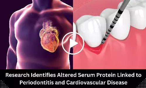 Research Identifies Altered Serum Protein Linked to Periodontitis and Cardiovascular Disease