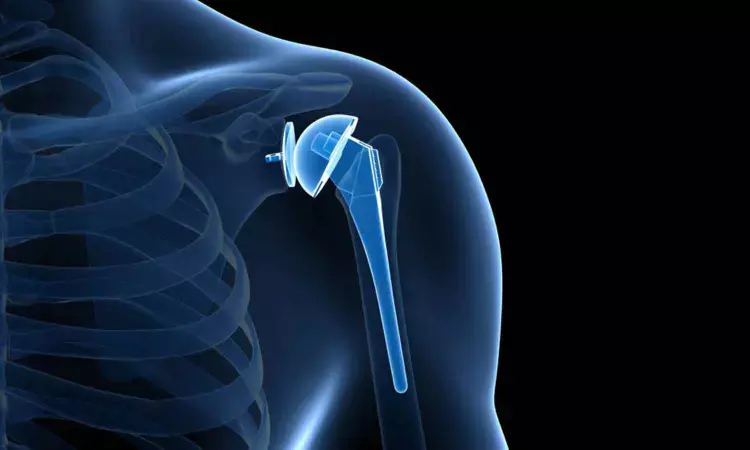 Shoulder hemiarthroplasty surgery within 2 weeks after sustaining proximal humerus fracture valid: study