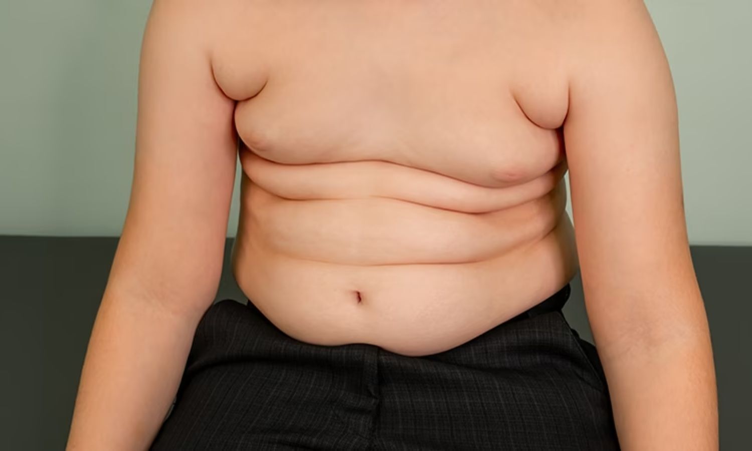 BMI Reduction Improves Cardiometabolic Risk in both metabolically healthy and unhealthy Obese Children: JAMA