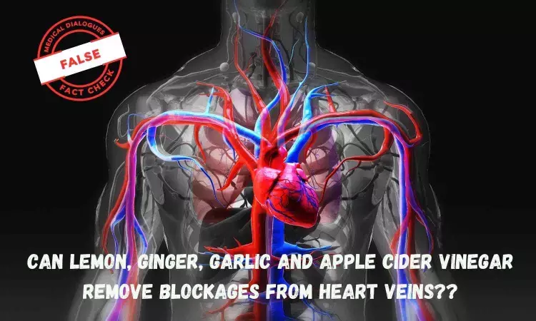 Fact Check: Can lemon, ginger, garlic and apple cider vinegar remove blockages from heart veins?