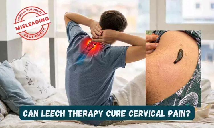 Fact Check: Can leech therapy fix cervical pain in seven sessions?