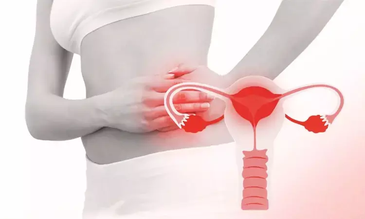 Pelvic Inflammatory Disease linked to Increased Risk of Serous Borderline Ovarian Tumors, study