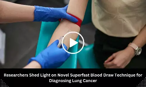 Researchers Shed Light on Novel Superfast Blood Draw Technique for Diagnosing Lung Cancer