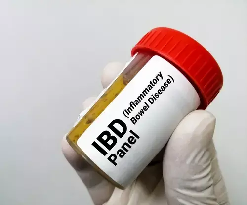 Higher Risk of COPD and Asthma observed in IBD Patients, Finds Study