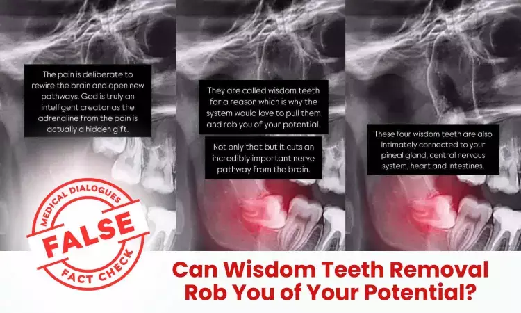 Fact Check: Can Wisdom Teeth Removal Rob You of Your Potential?