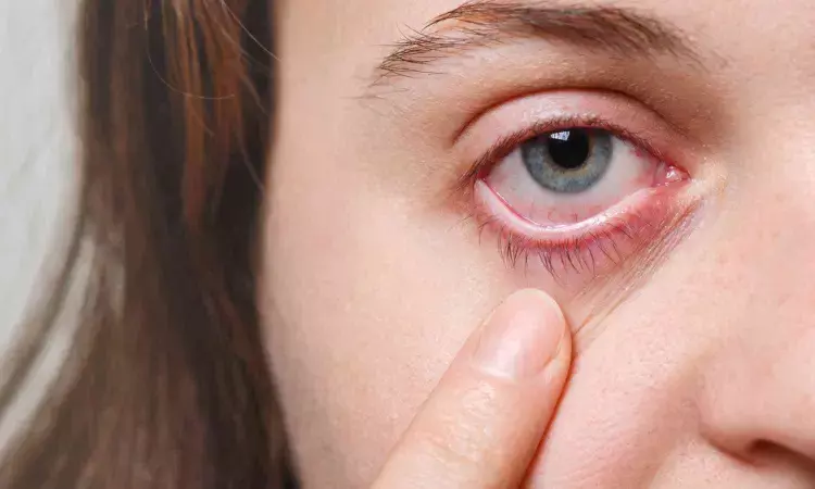 Long-term antiviral use key to ocular shingles treatment, suggests study