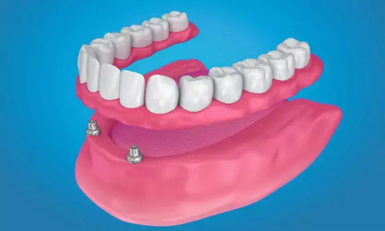 Root-Retained Overdentures Enhance Stability and Patient Satisfaction confirms Systematic Review