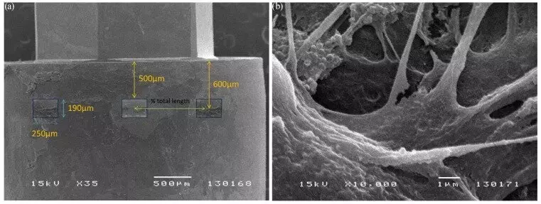 Enzymatic cleaners fail to decontaminate and establish sterile surface in used healing abutments: Study