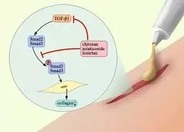 Losartan hydrogel may decrease size of scar and remodel tissue to enhance wound repair: Study