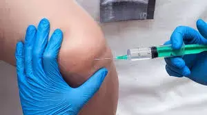 Long acting injection of Fluticasone promising in knee osteoarthritis, reveals research