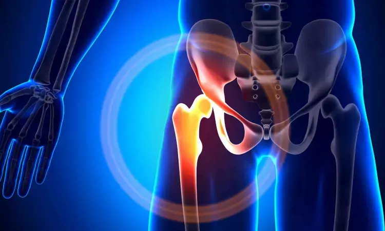 Study Finds Variability in Patient Outcomes in quality of Life After Hip Replacement Surgery