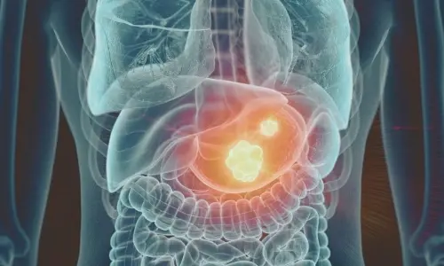 Potassium-Competitive Acid Blockers: AGA Review Offers Insights on Optimal Use in GI Disorders Potassium-Competitive Acid Blockers: AGA Review Offers Insights on Optimal Use in GI Disorders