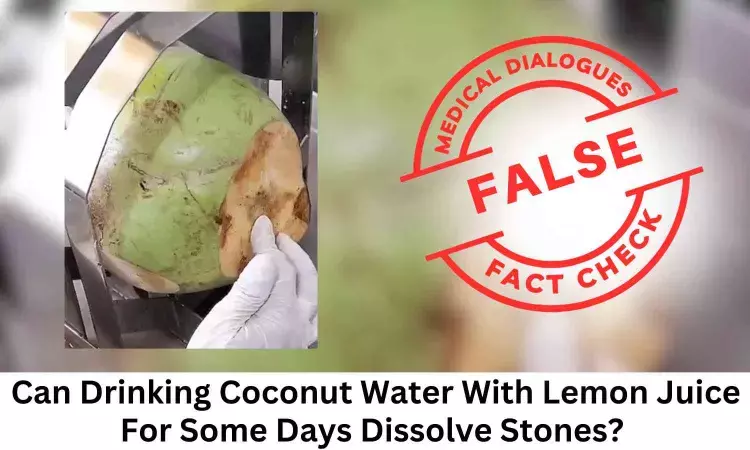 Fact Check: Can Drinking Coconut Water With Lemon Juice Dissolve Stones?