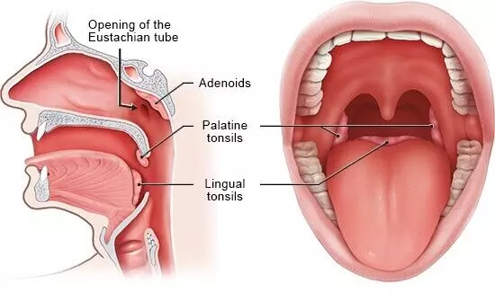 Location of the tonsils.