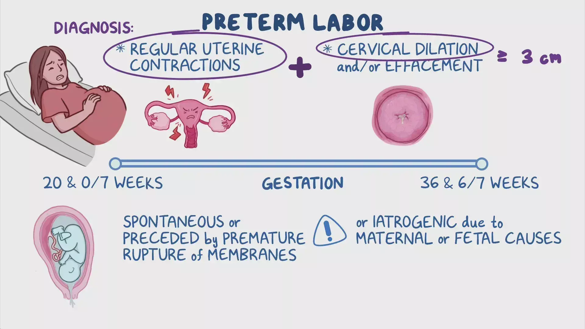 Spontaneous preterm labour has a significant association wth UTIs,  finds study