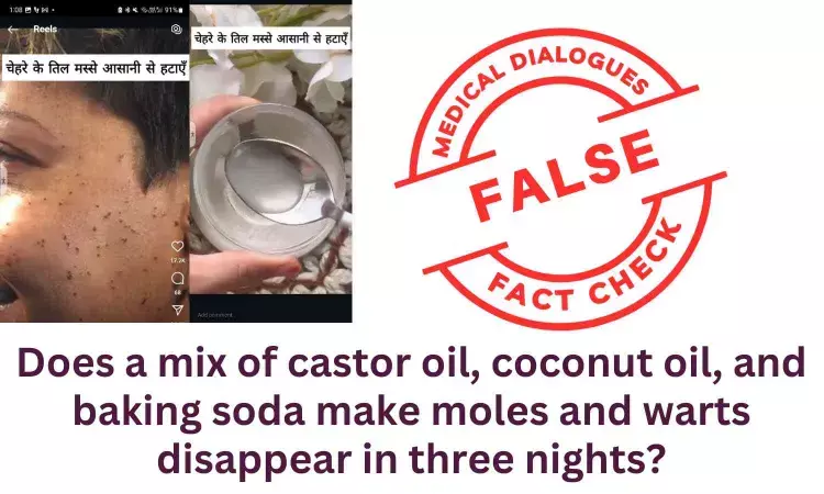 Fact Check: Does a mix of castor oil, coconut oil, and baking soda make moles and warts disappear in three nights?