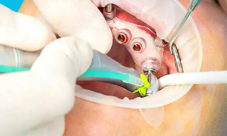 Nonguided implant placement approach okay for placement of One-piece mini-implants to support mandibular overdenture: Study