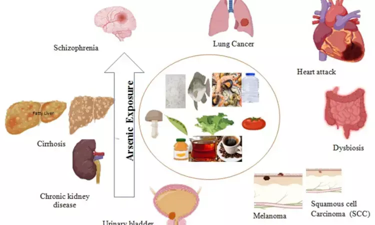 Single Arsenic and Cadmium exposure positively associated with increased CKD risk, reports study