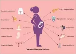 Gestational diabetes early in pregnancy tied to risk of  postpartum glucose intolerance,  finds study