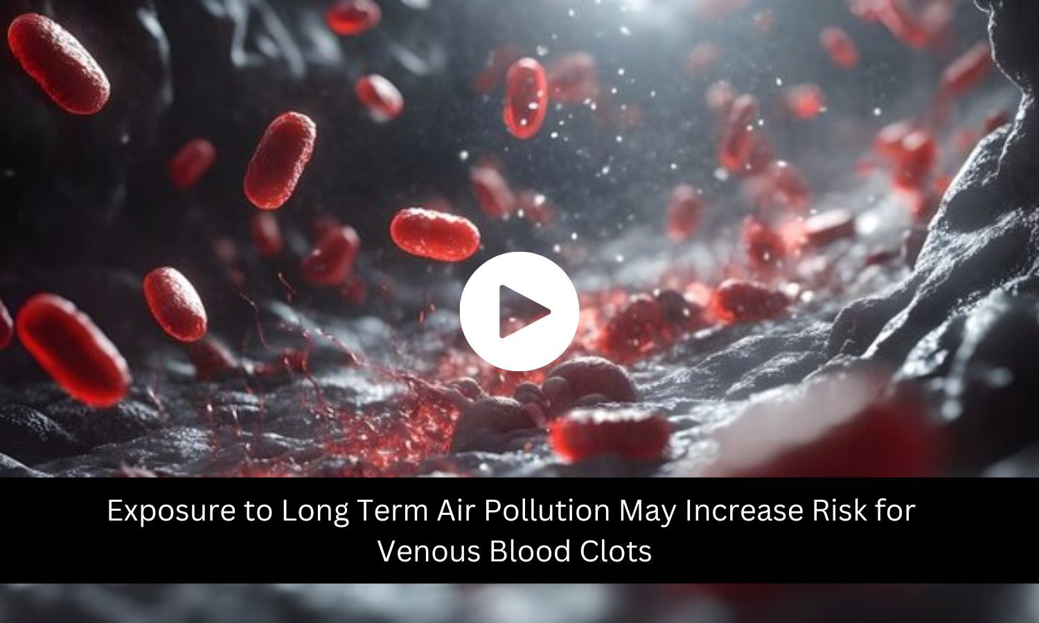 Exposure To Long Term Air Pollution May Increase Risk For Venous Blood