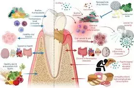 Older children and boys with IBD have more periodontal treatment needs, compared to controls: Study