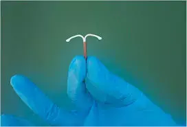 Very few levonorgestrel 52-mg IUD users discontinue IUD due to severe enough hormone-related side effects: Study