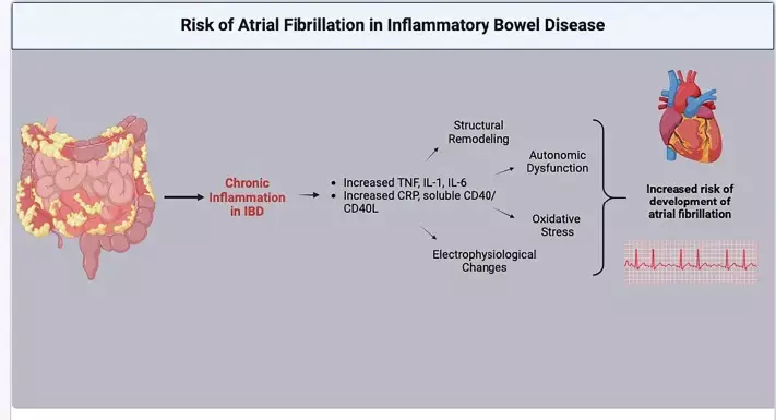 Study highlights association of IBD with left ventricular, atrial dysfunction, arrhythmias & heart failure