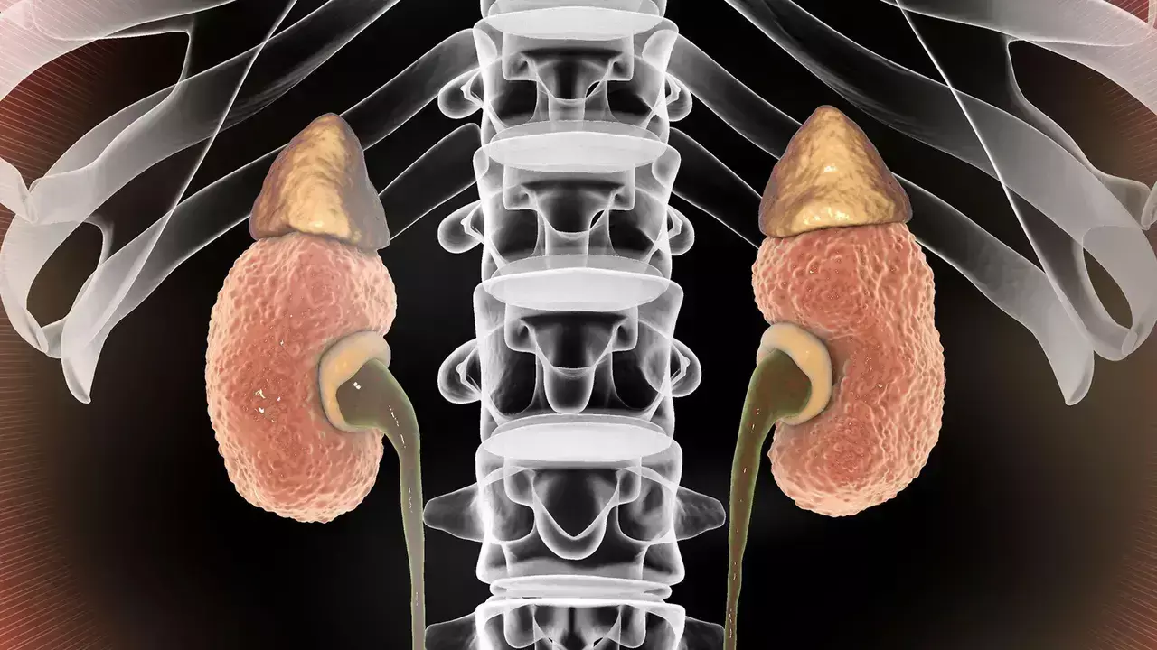 Gestational exposure to NSAIDs associated with childhood CKD, finds JAMA study