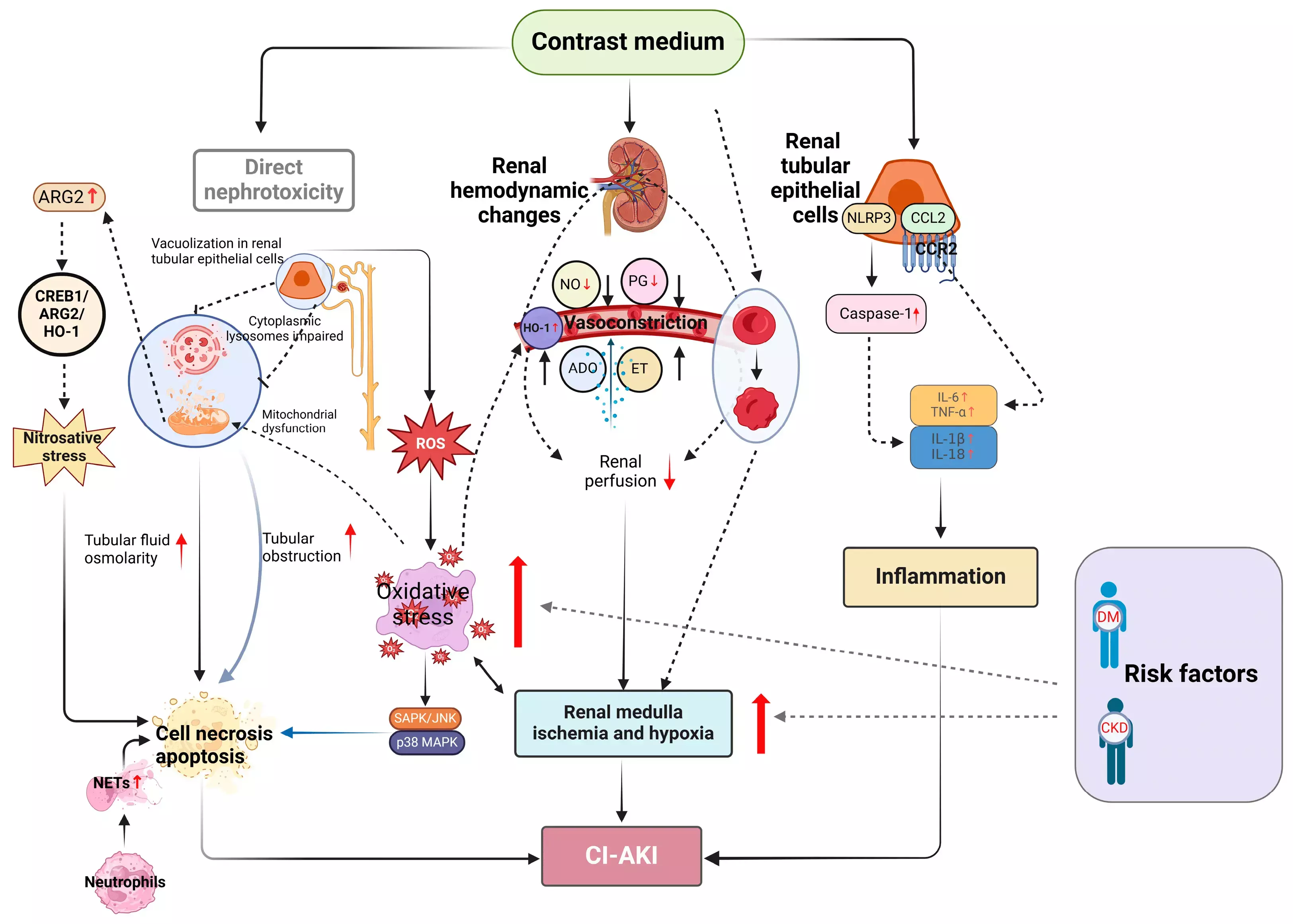 Prophylactic Trimetazidine may prevent contrast induced AKI in patients undergoing CAG or PCI: Study