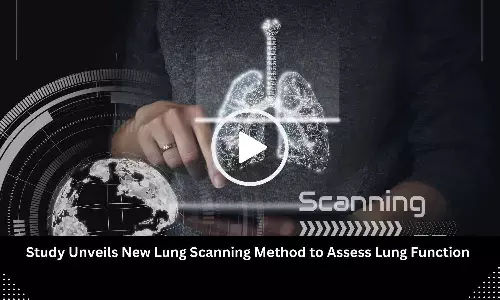 New Lung Scan Technology Enables Real-Time Monitoring of Airflow in COPD, Transplant Patients: Study Finds