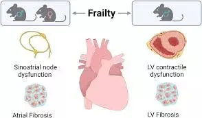 Frailty significantly elevates risk of adverse outcomes among patients undergoing CABG, reveals study