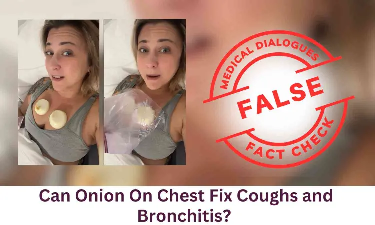 Fact Check: Can putting Onion On Chest Fix Coughs and Bronchitis?