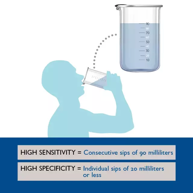 3-ounce water swallow test reliable screening tool for  dysphagia among  children: Study