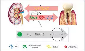 Periodontal Care may Lower Risk of nephropathy and Dialysis Initiation in Diabetes patients,  reveals research