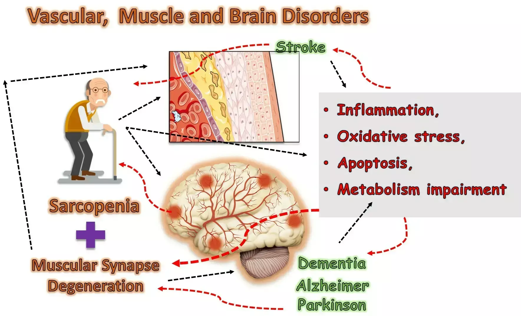 Higher Albumin Levels tied to Reduced Daily Functioning Impairment in Stroke Patients, finds study