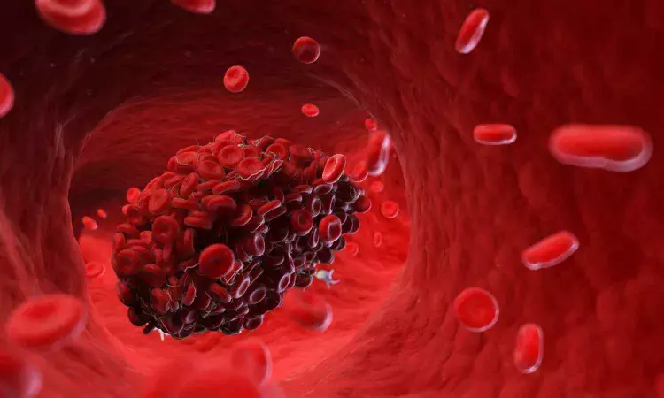 Light therapy promising approach to thrombus prophylaxis, suggests study