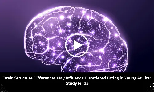 Brain Structure Differences May Influence Disordered Eating in Young Adults: Study Finds