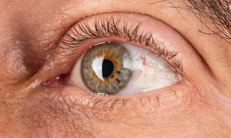 Research reveals potential treatment for inherited blinding disease retinitis pigmentosa