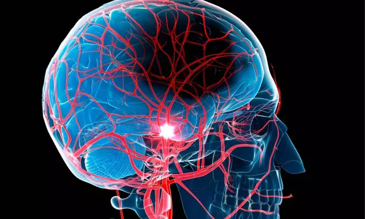 Stem cell therapy jumpstarts brain recovery after stroke, reveals research