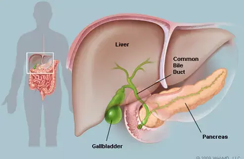 Ursodeoxycholic acid may Reduce need of Cholecystectomy for  gallstones after laparoscopic sleeve gastrectomy: Study