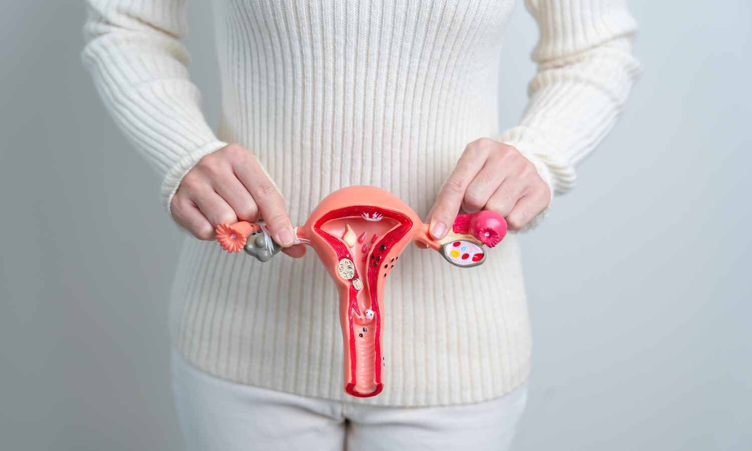 ACOG Releases Updated Clinical Guidance on Endometriosis to Accelerate Diagnosis and Improve Access to Care