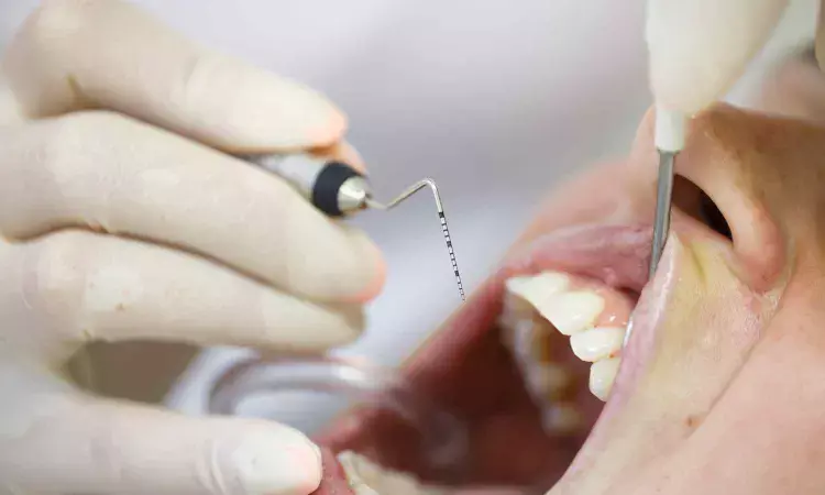 Study Links Molar Incisor Hypomineralization to Increased Risk of Periodontitis in Adolescents