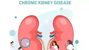 Depressive and anxiety symptoms tied to progression to kidney failure in patients with diabetic nephropathy: Study